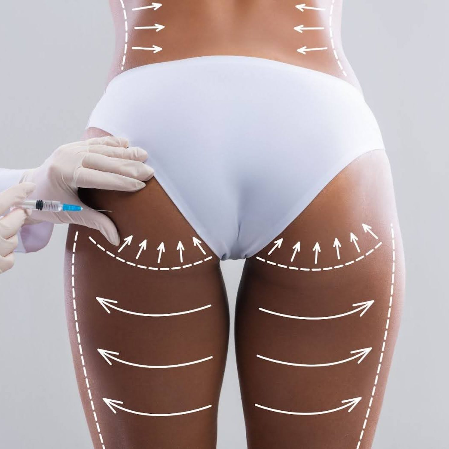 How-Long-Does-a-BBL-Last